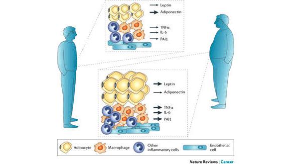 cancer-obesse-26112014-001