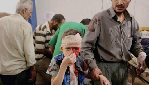 طفل أصيب في قصف على مدينة دوما